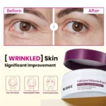 Parches Para Ojos De Colágeno Cálcico Koec 60 Unidades - Imagen 5